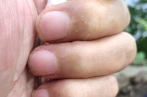 餐条钓鱼技巧教程？如何提高钓获率？