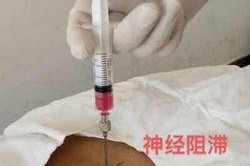 二段式钓组浮针技巧是什么？如何提高钓鱼效率？