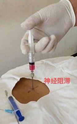 二段式钓组浮针技巧是什么？如何提高钓鱼效率？  第1张